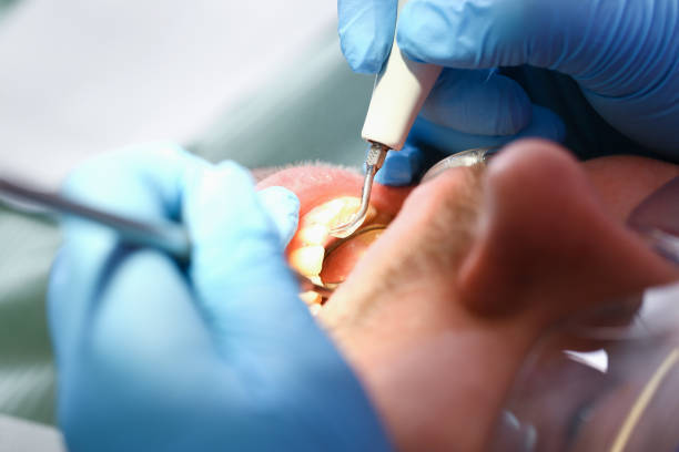 Best Emergency Denture Repair in Cherry Brah, NC
